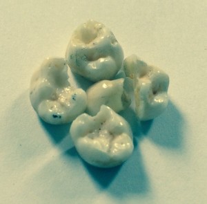 Teeth 1